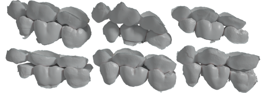 FDI 16 Crown Dataset samples