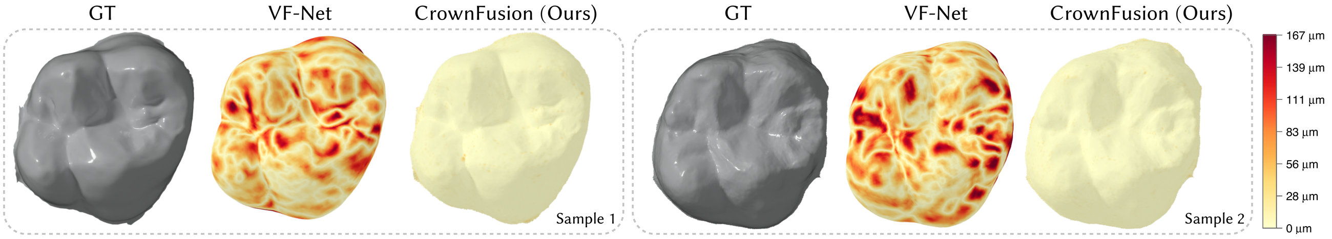 Reconstruction comparison